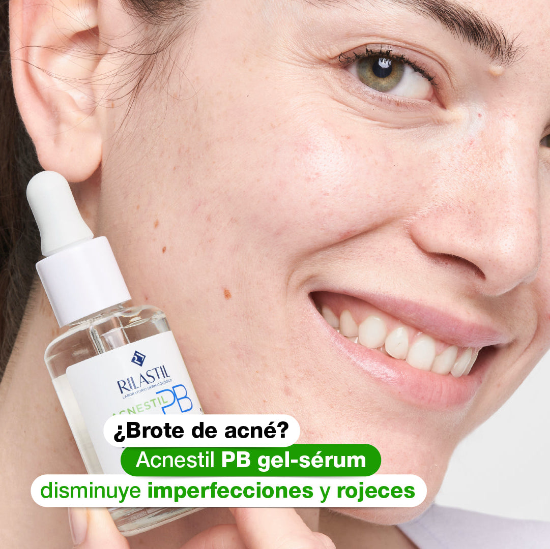 GEL CALMANTE SERBONOMALIZADOR 30 ML